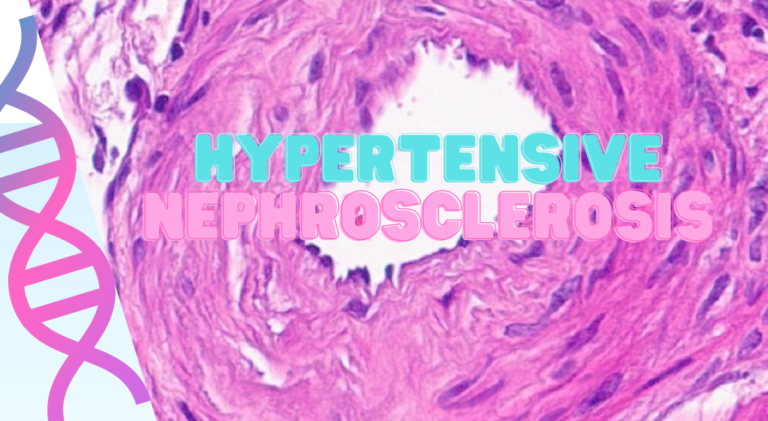 Hypertensive Nephropathy A Silent Threat To Your Kidney Health