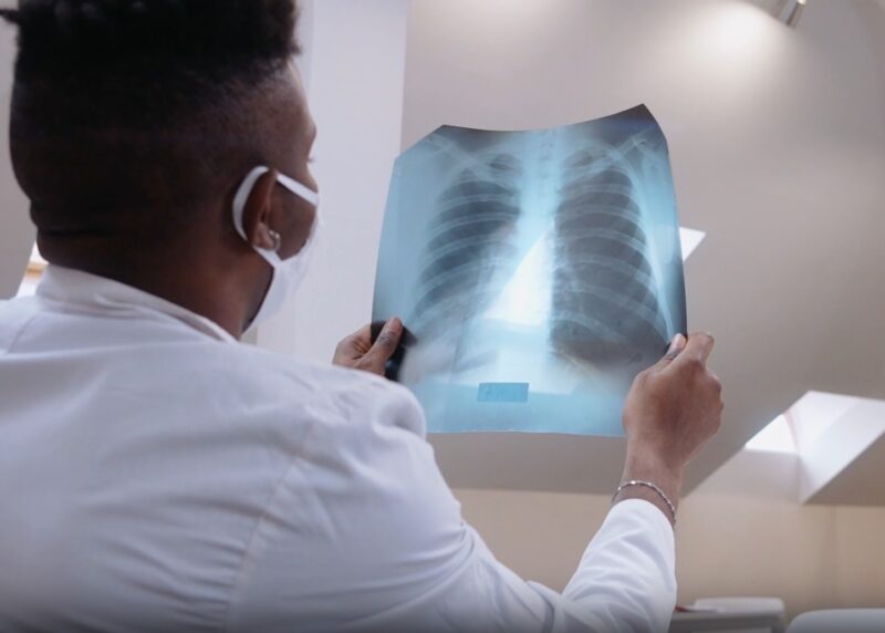 A female doctor examining an X-ray of lungs in a hospital setting